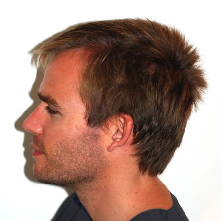 Side profile example photo