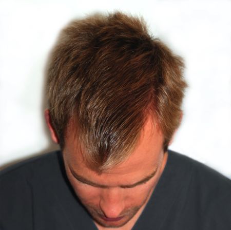 Top of head example photo